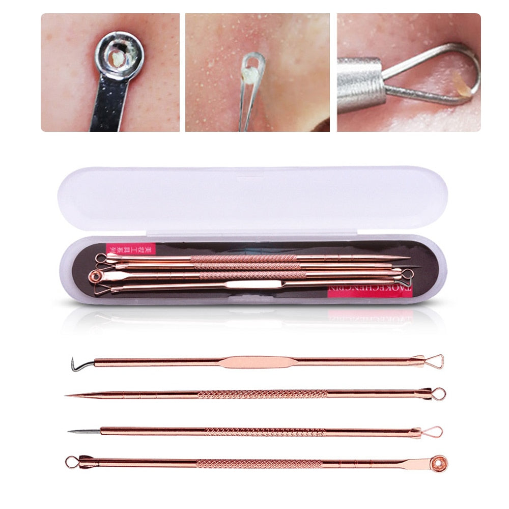 4pc Blackhead Remover Set