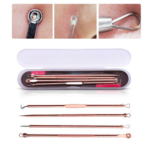 4pc Blackhead Remover Set